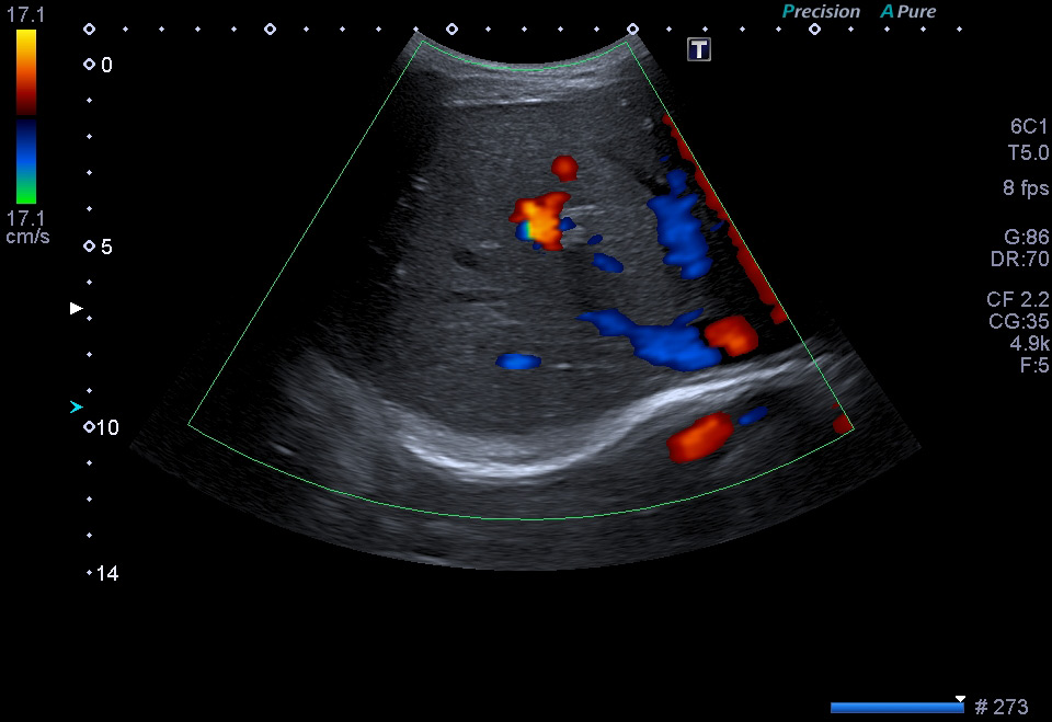 Echographies générales (abdominale, gynécologique, thyroidienne ...